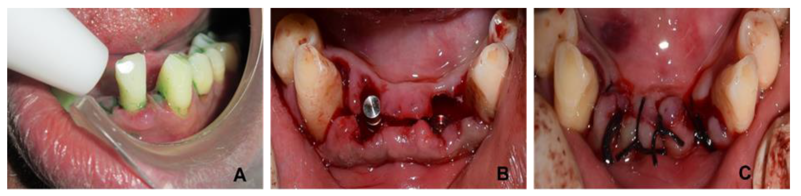 Photonics 09 00480 g001