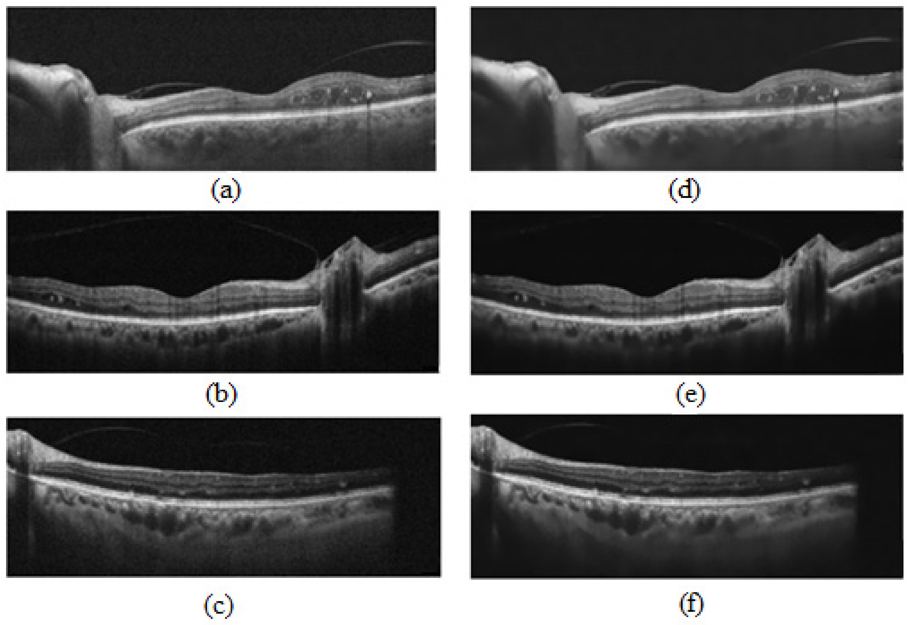 Photonics 10 00234 g003