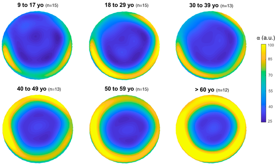 Photonics 10 00467 g001 Photonics 10 00467 g001