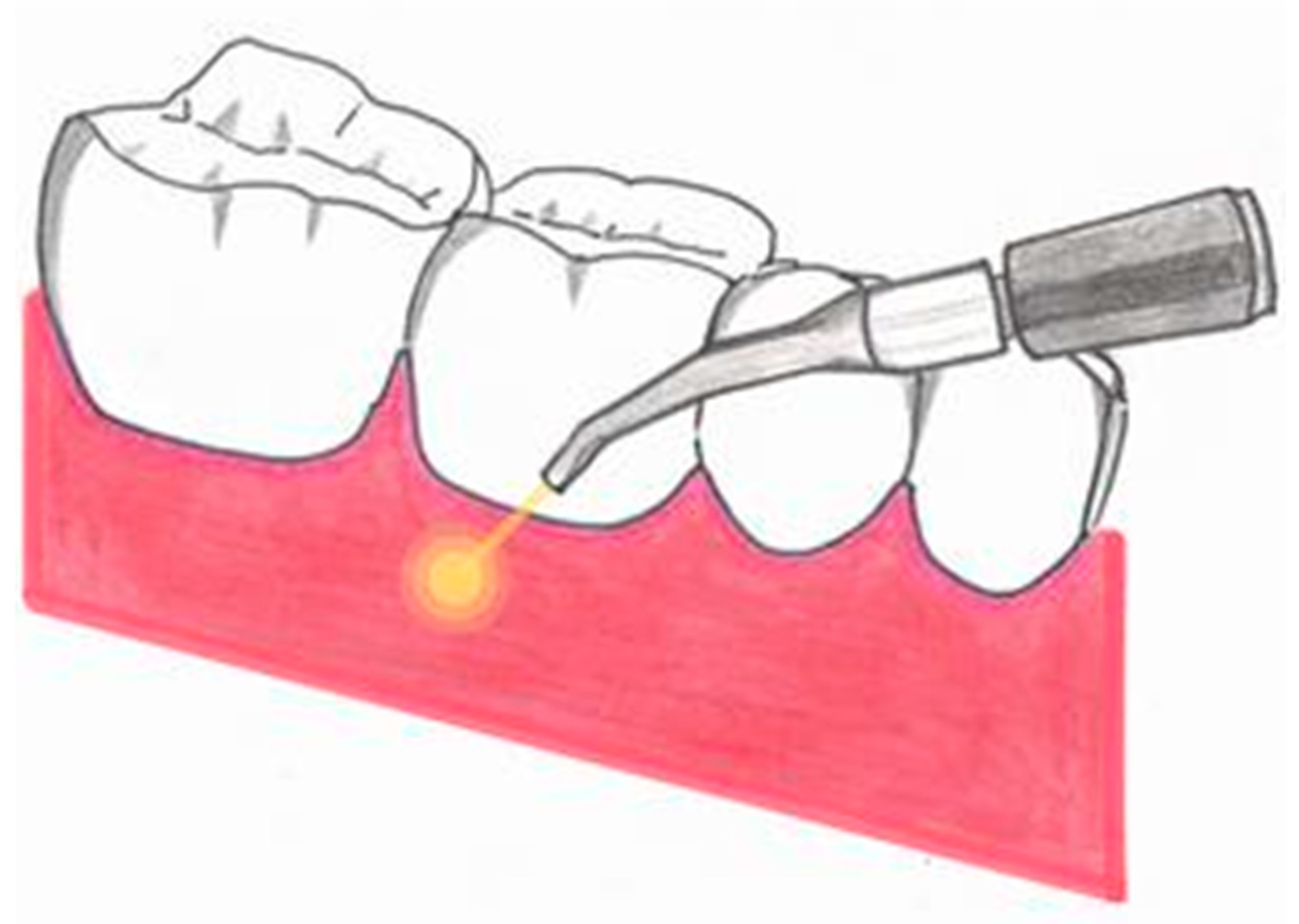 Photonics 10 00650 g001
