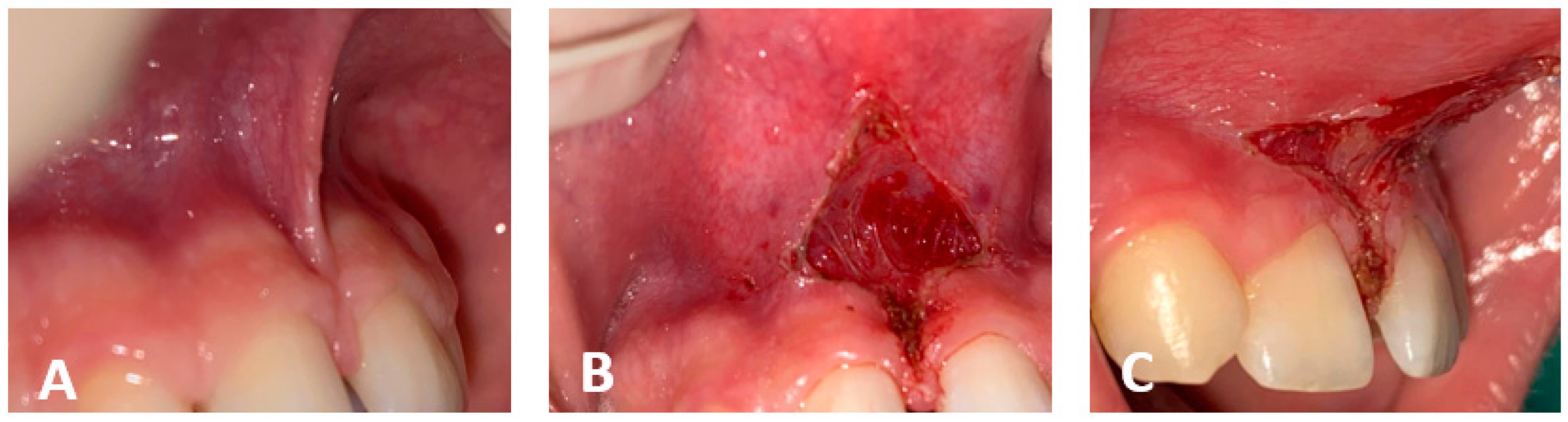 Photonics 10 00650 g004
