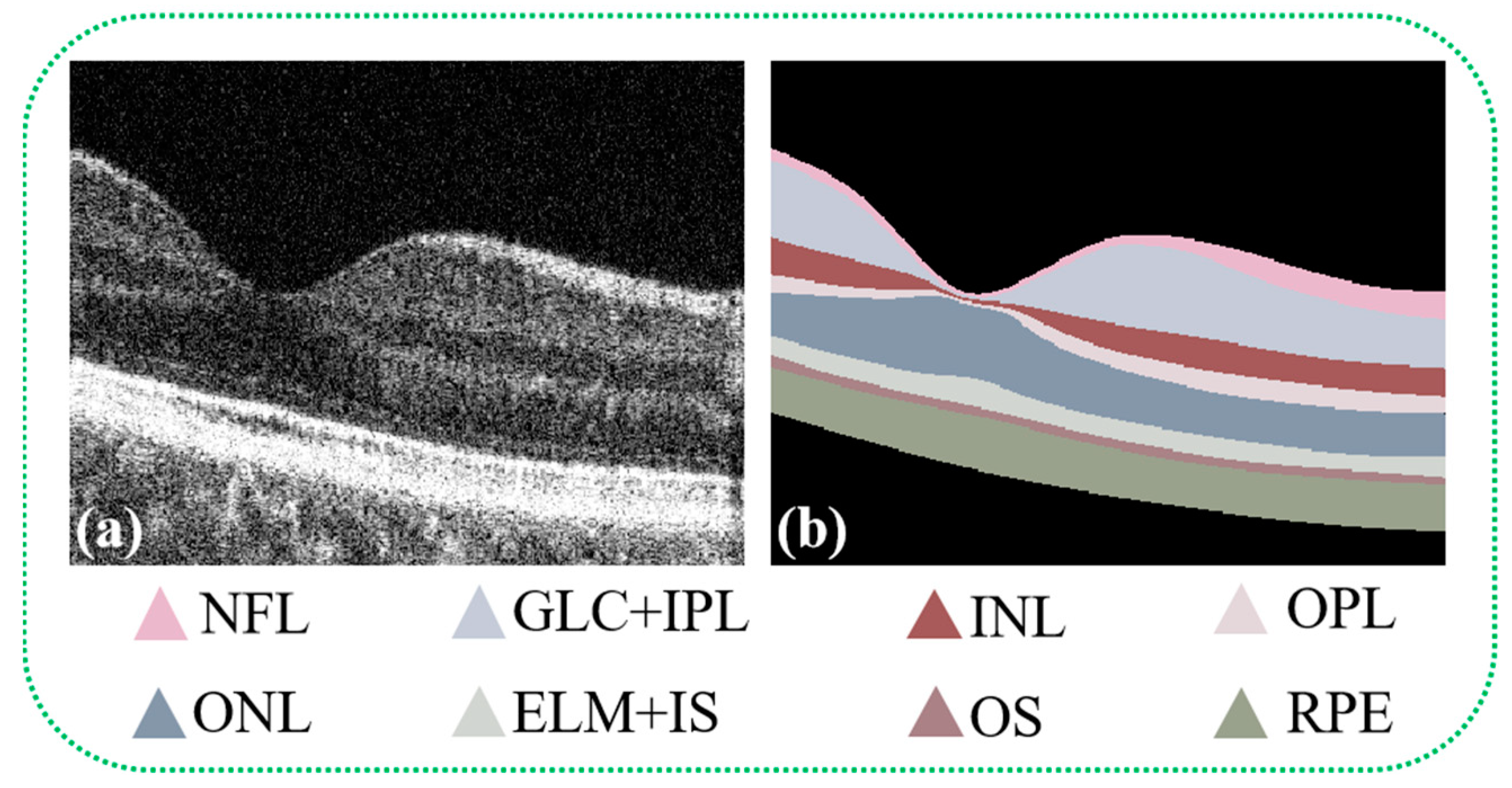 Photonics 11 00607 g001