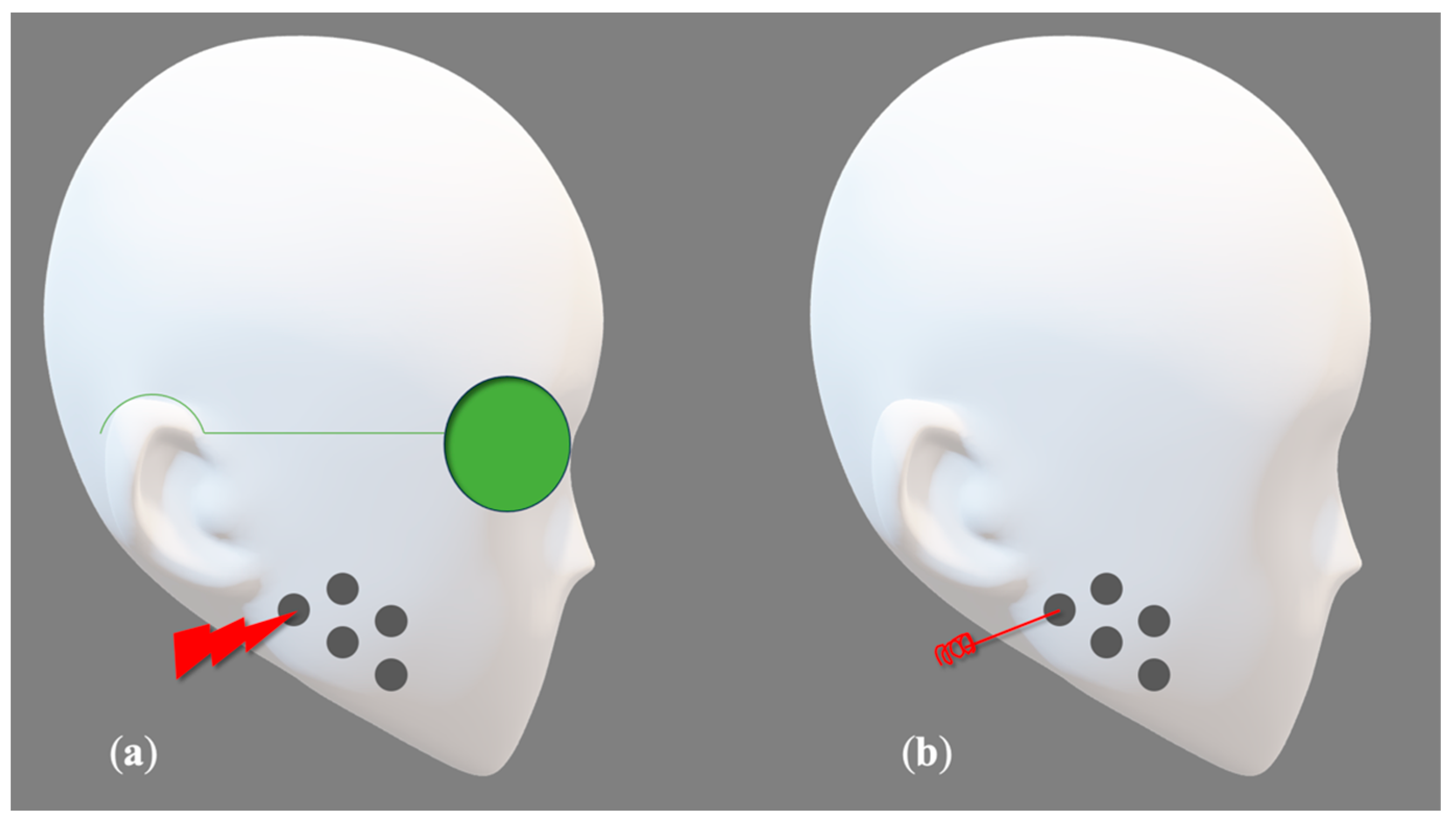 Photonics 11 00965 g001 Photonics 11 00965 g001