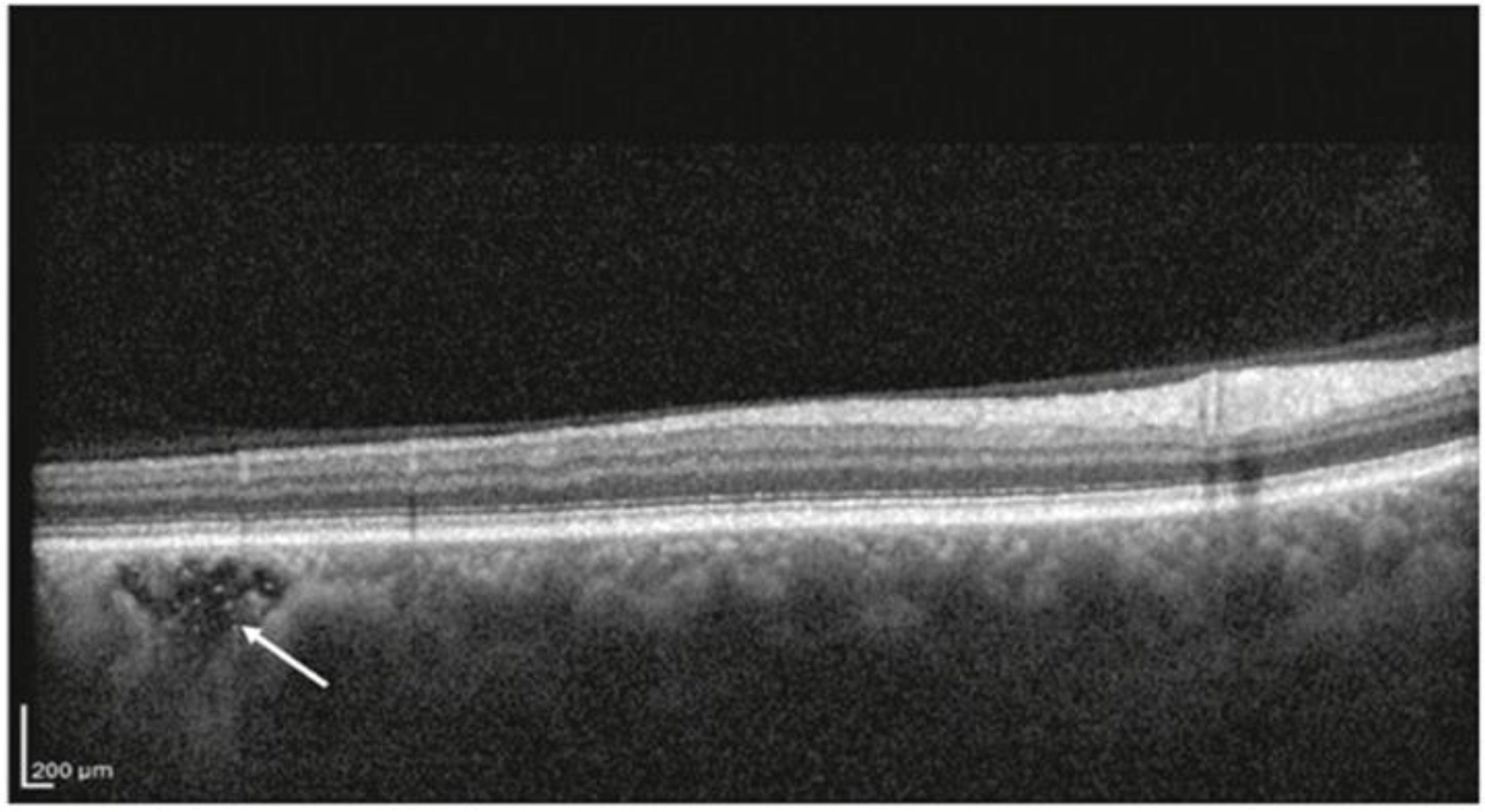 Photonics 12 00237 g004