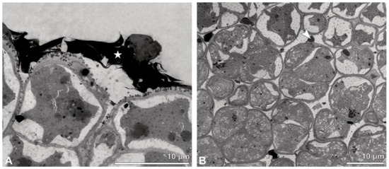 Plants 13 01114 g018