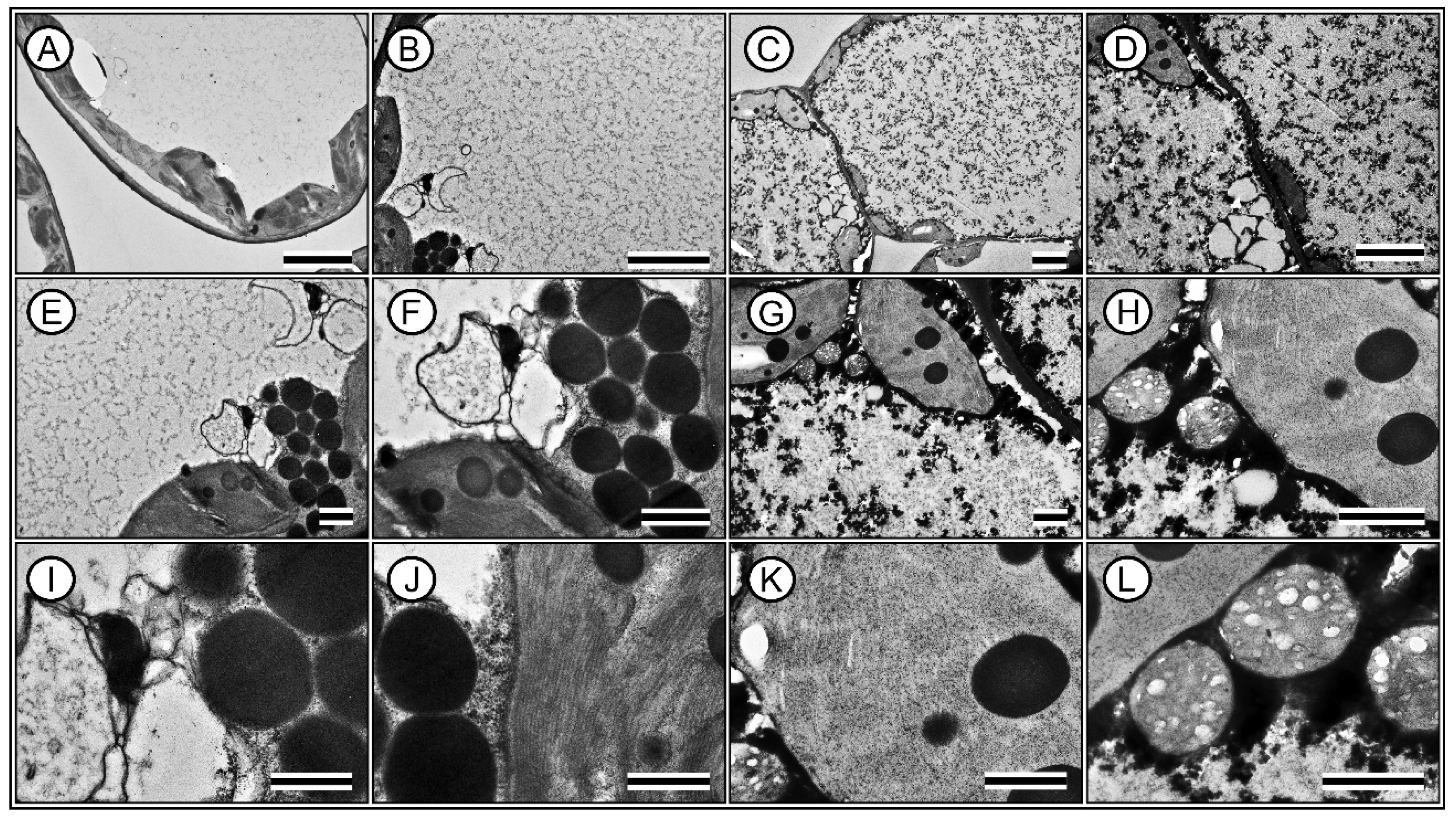 Plants 13 02831 g011