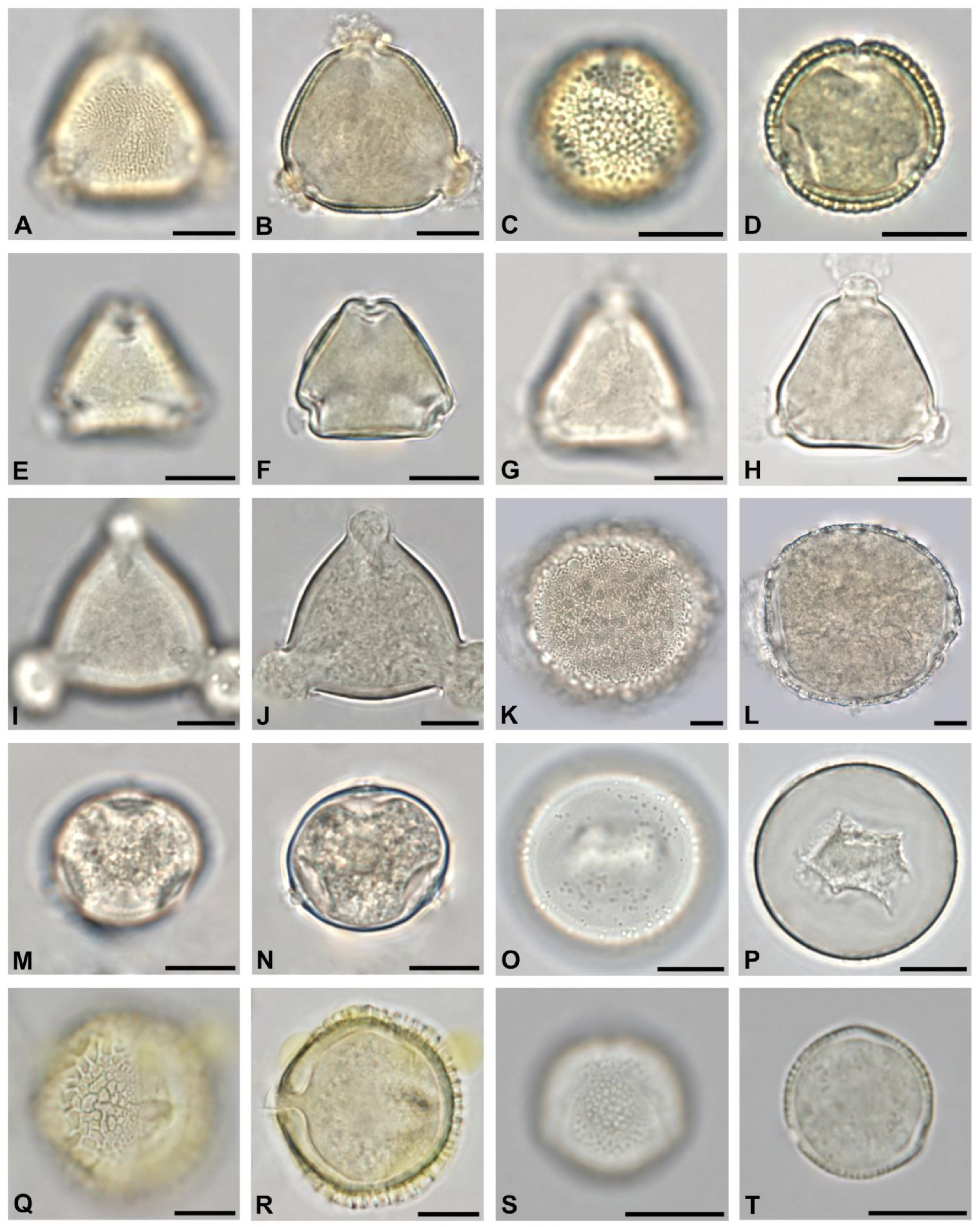 Plants 13 03094 g005