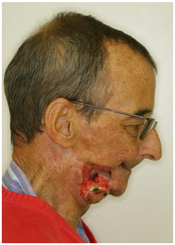 Polymers 04 00691 g003 1024