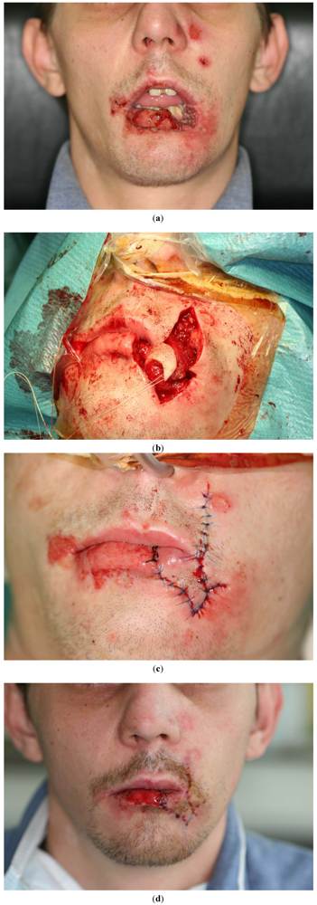 Polymers 04 00691 g005
