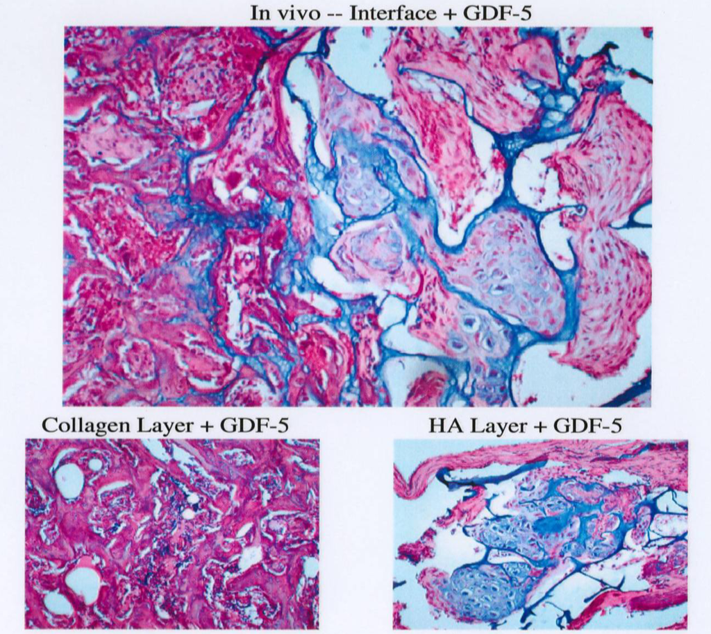 Polymers 04 00997 g006 1024