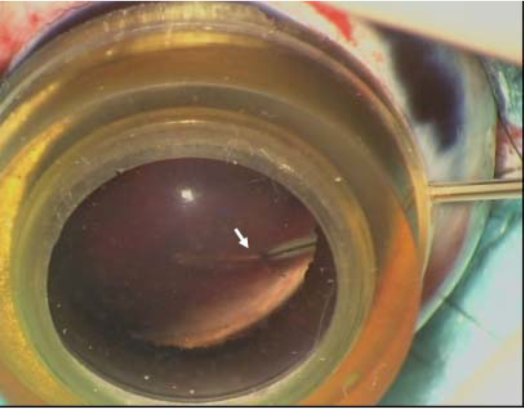 Polymers 06 00243 g004 1024