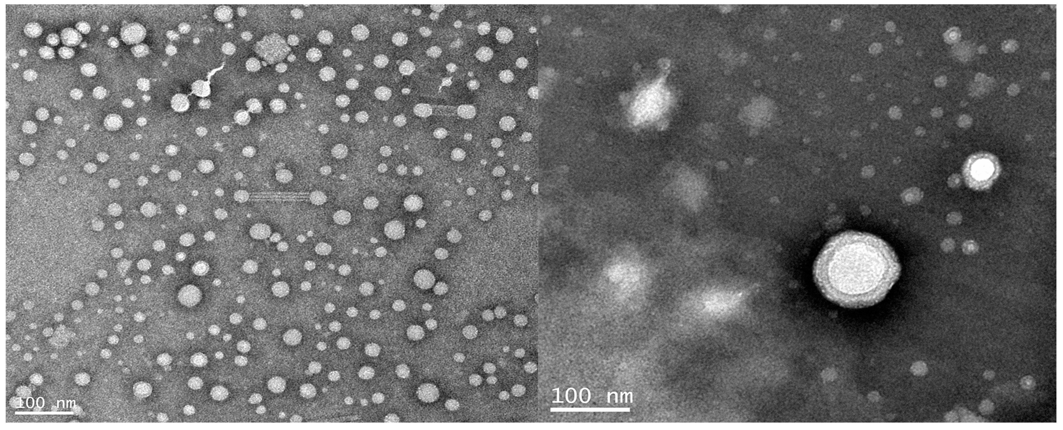 Polymers 10 00154 g008