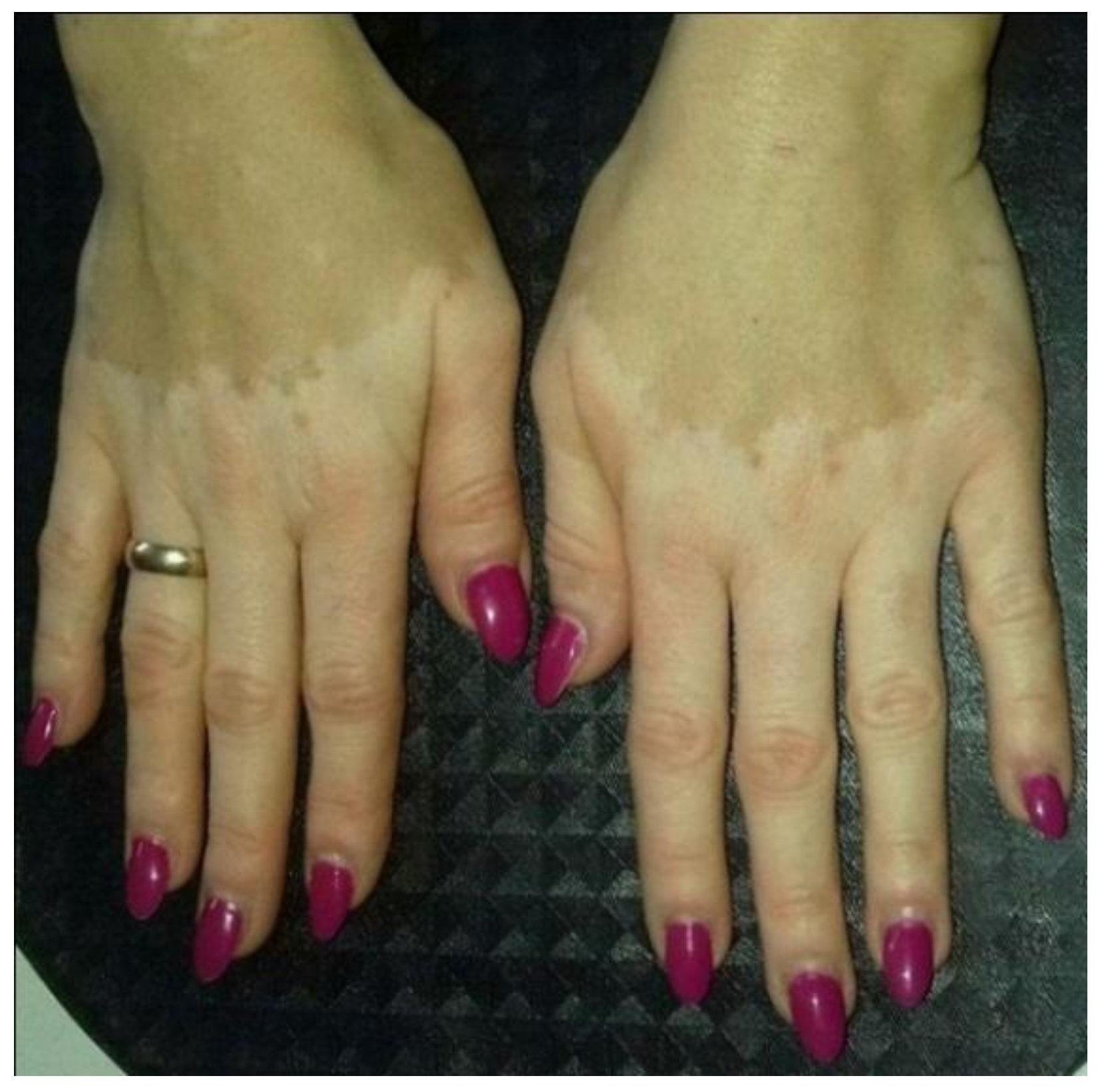 Polymers 10 00438 g002