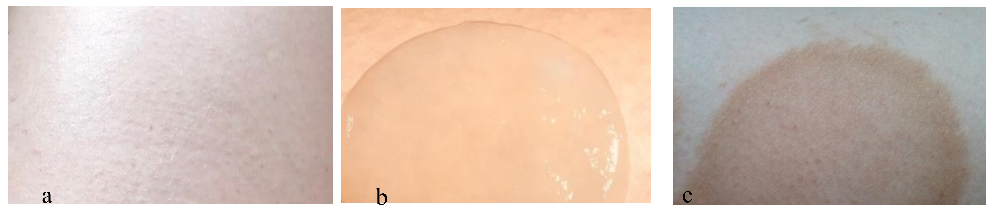 Polymers 10 00438 g006