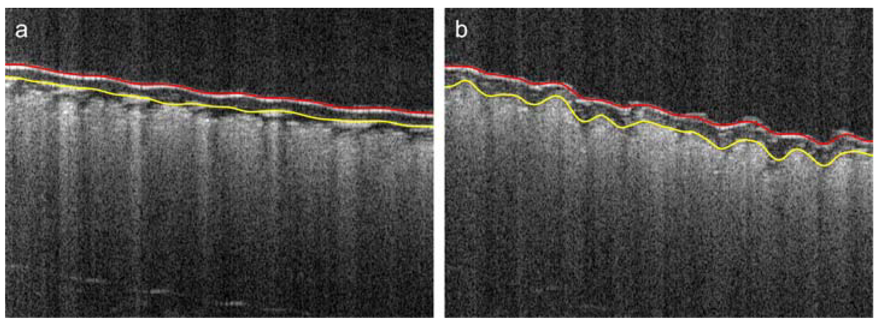 Polymers 10 00469 g015