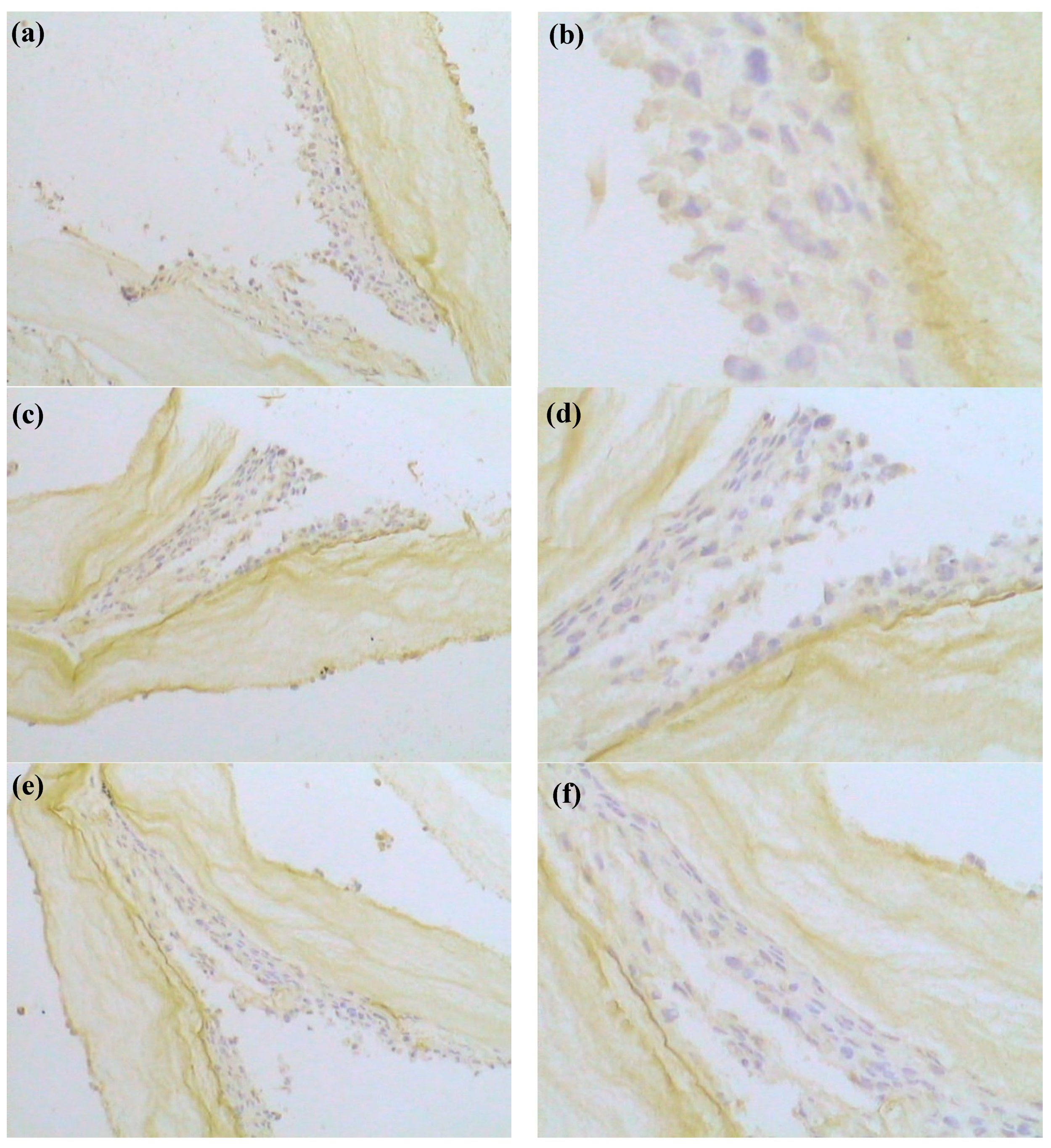Polymers 10 00581 g008 Polymers 10 00581 g008