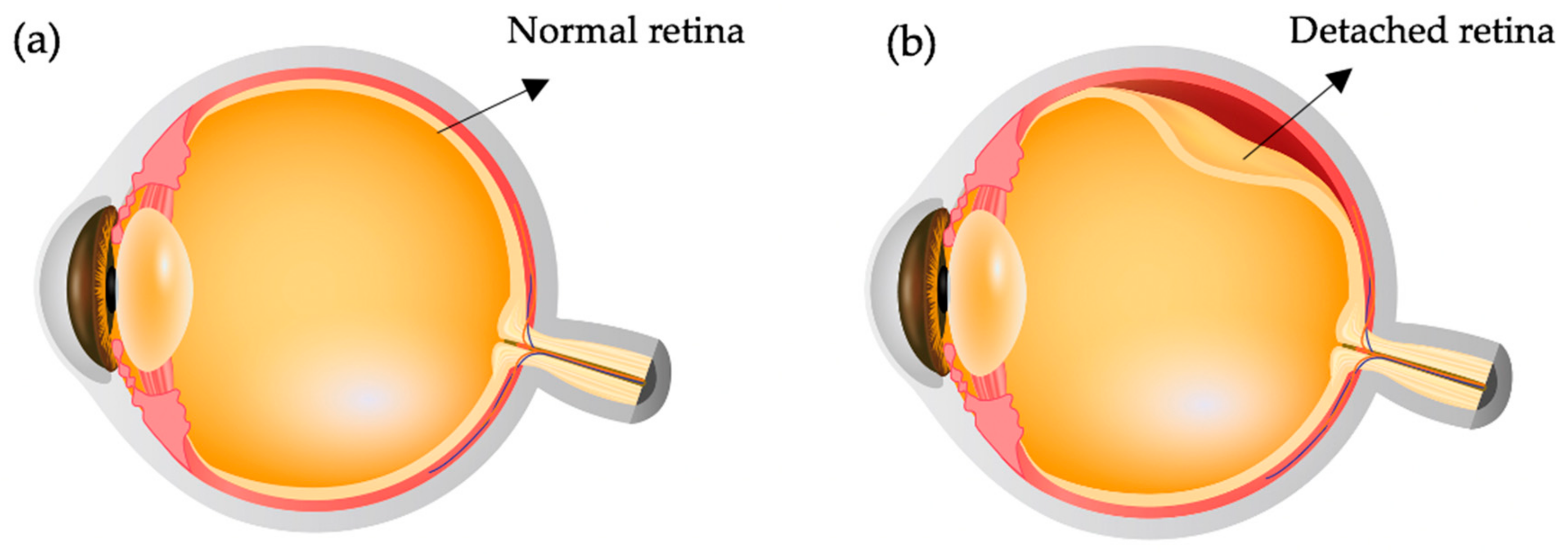 Polymers 13 00121 g002