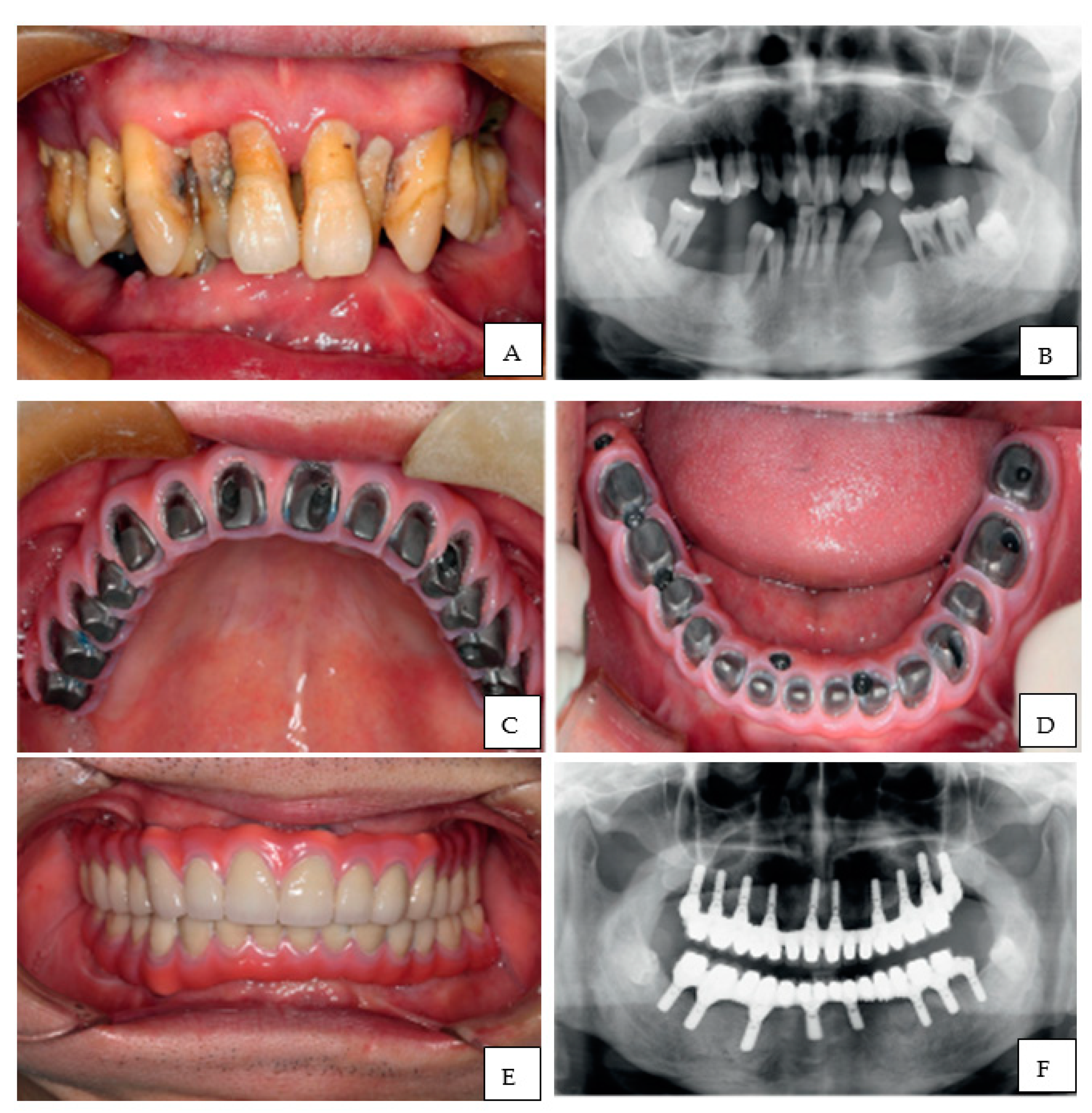 Polymers 13 00157 g004