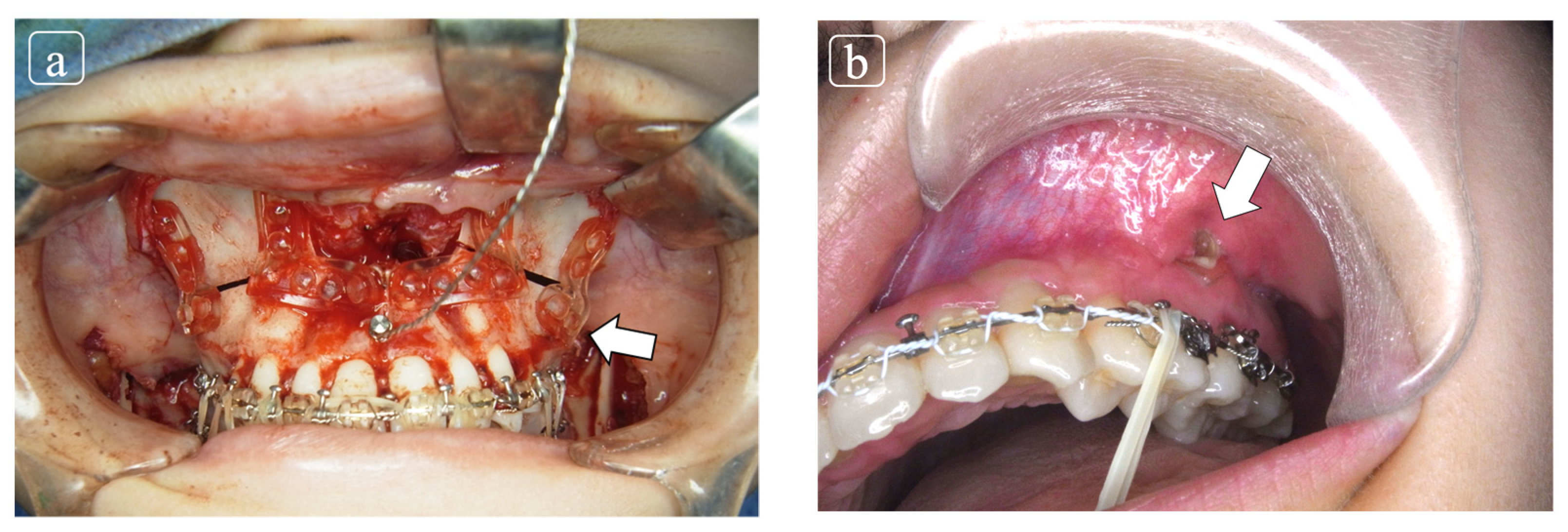 Polymers 13 00889 g002