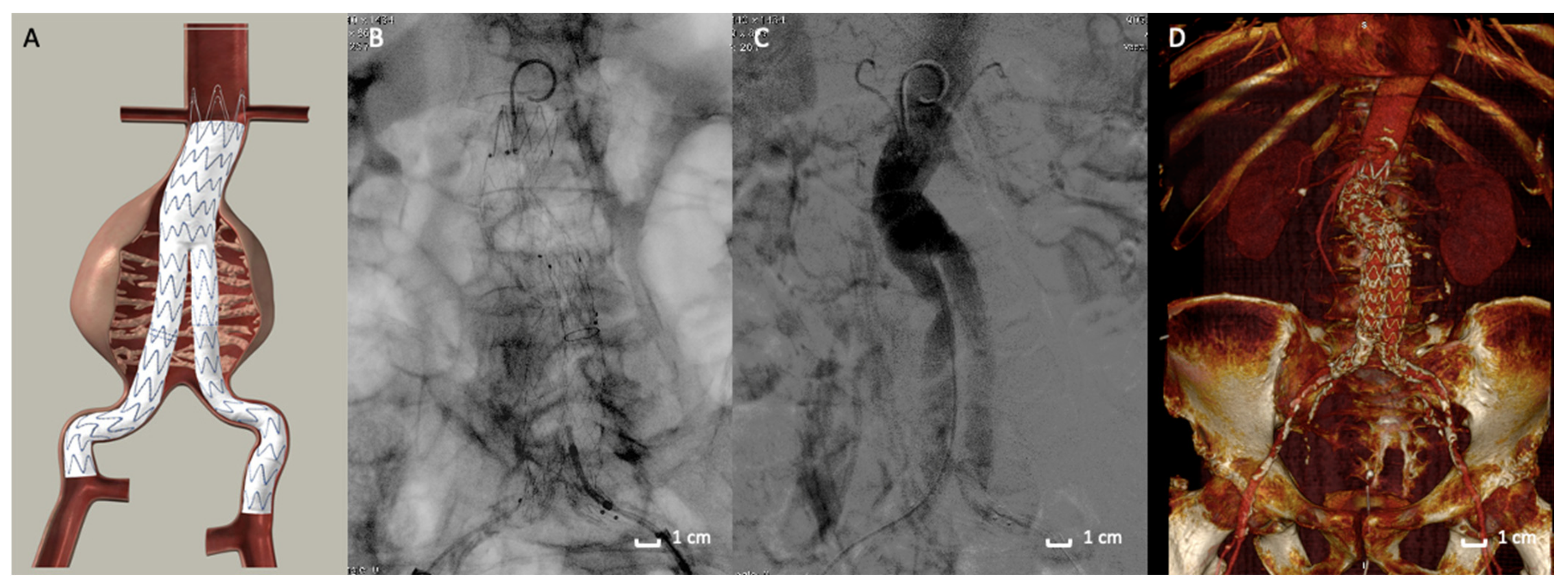 Polymers 13 01196 g001 Polymers 13 01196 g001