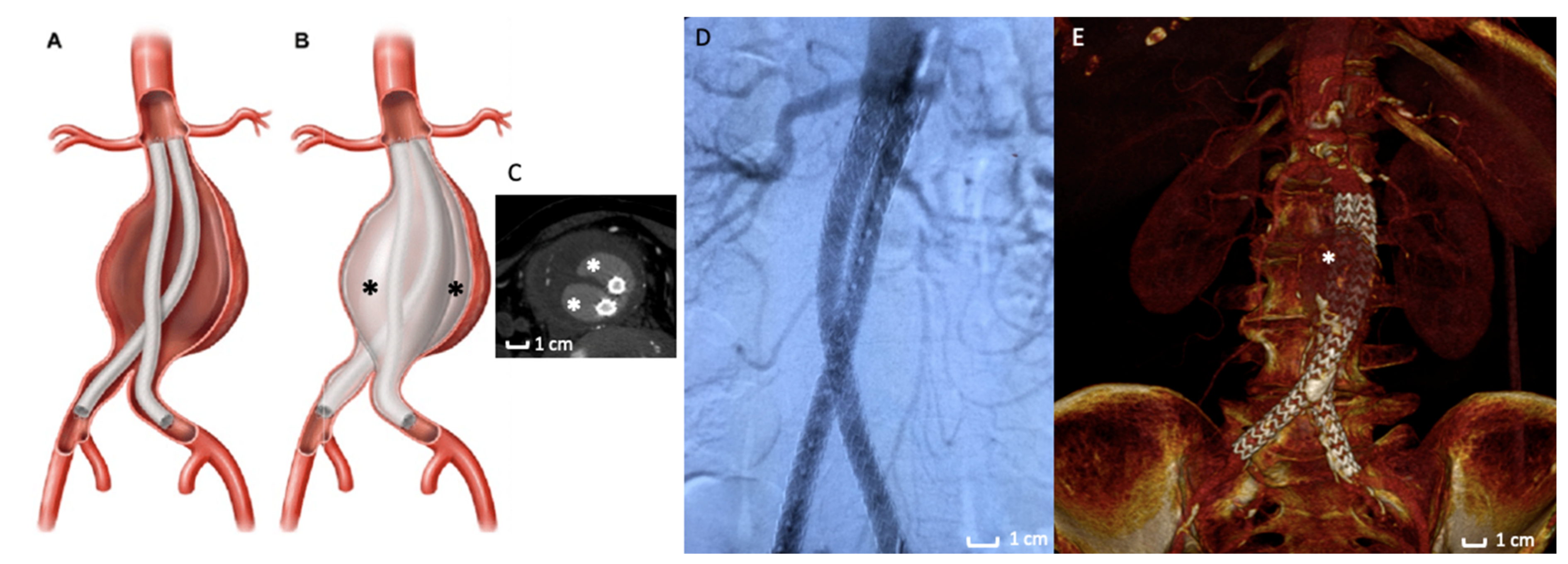 Polymers 13 01196 g002 Polymers 13 01196 g002