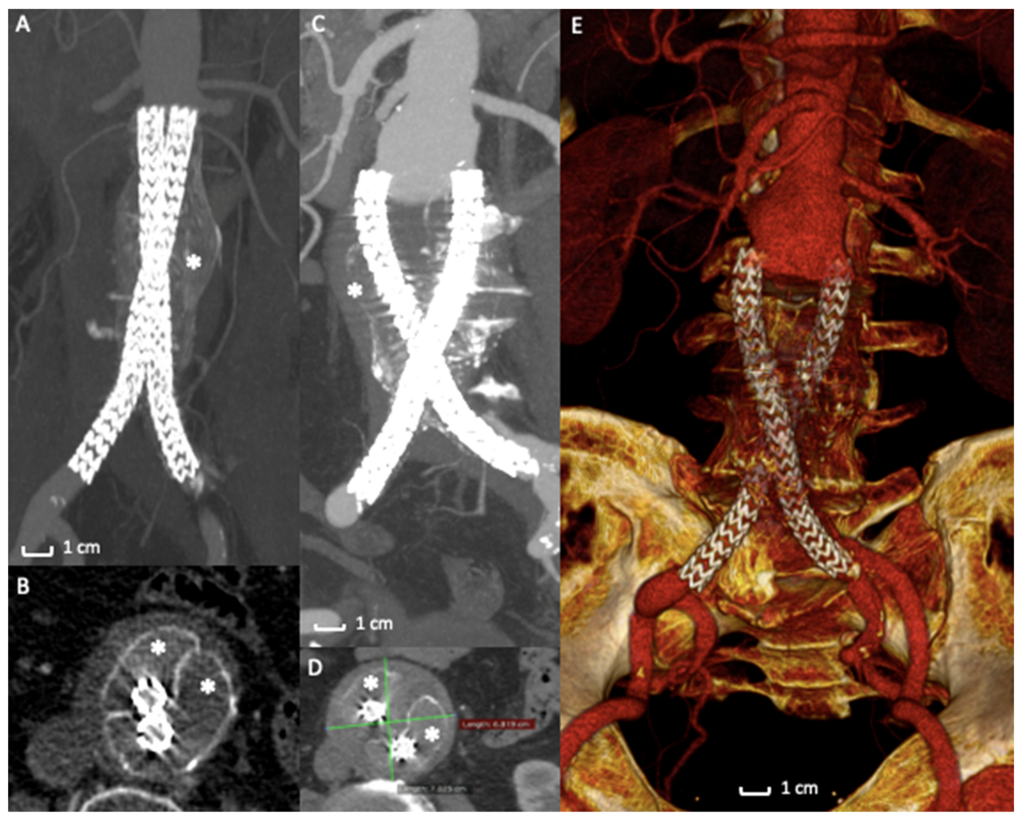 Polymers 13 01196 g004 Polymers 13 01196 g004
