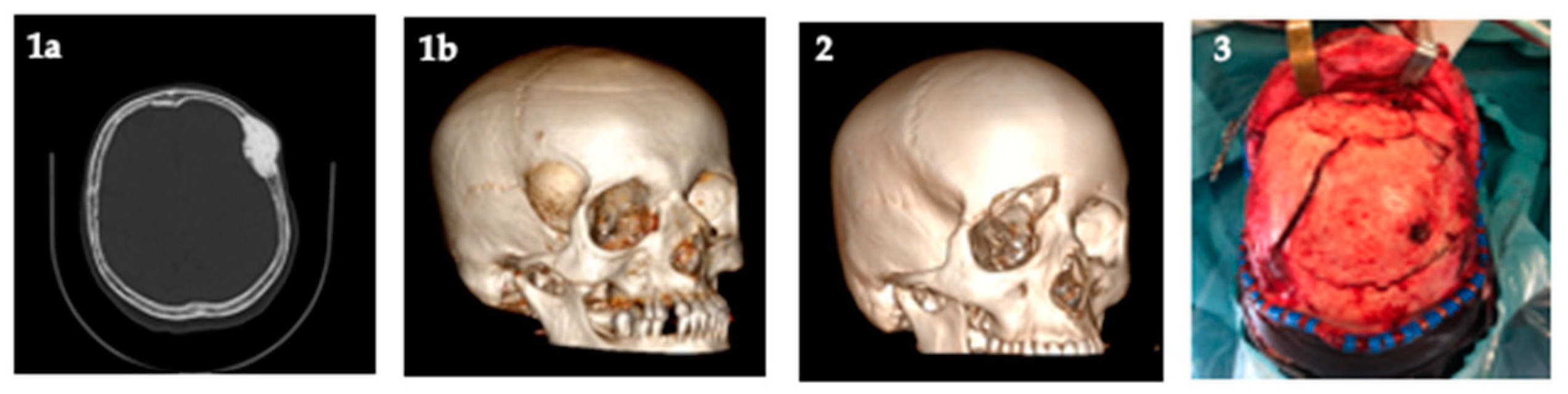 Polymers 13 01452 g001 Polymers 13 01452 g001
