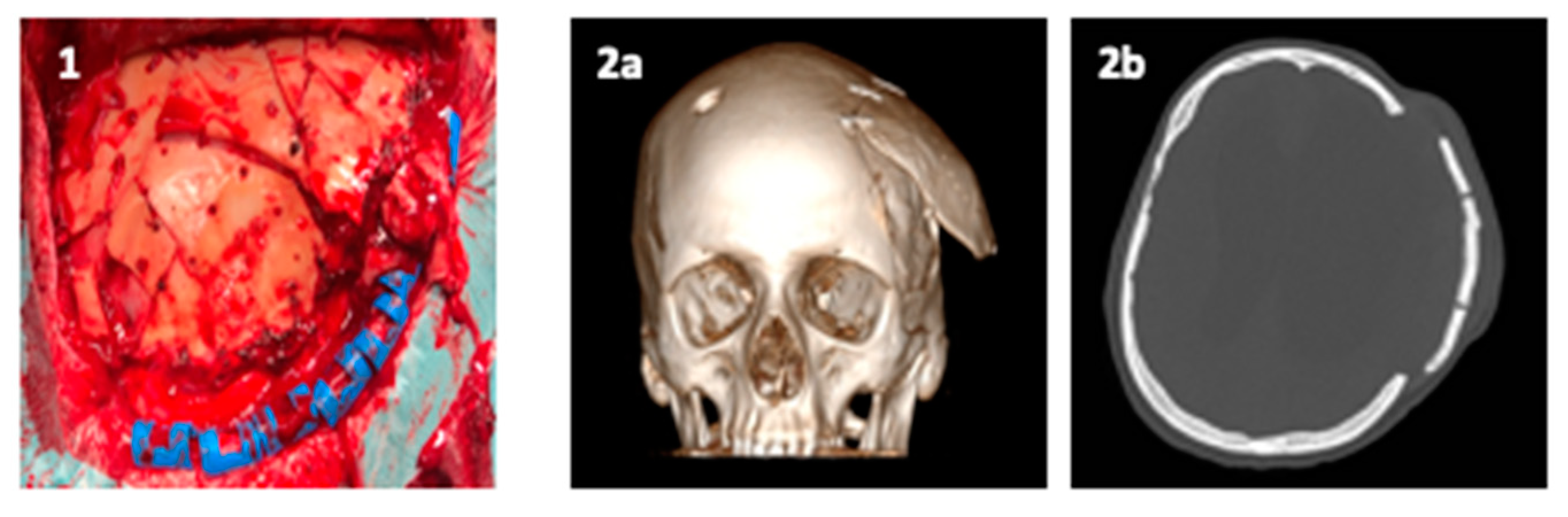 Polymers 13 01452 g005 Polymers 13 01452 g005