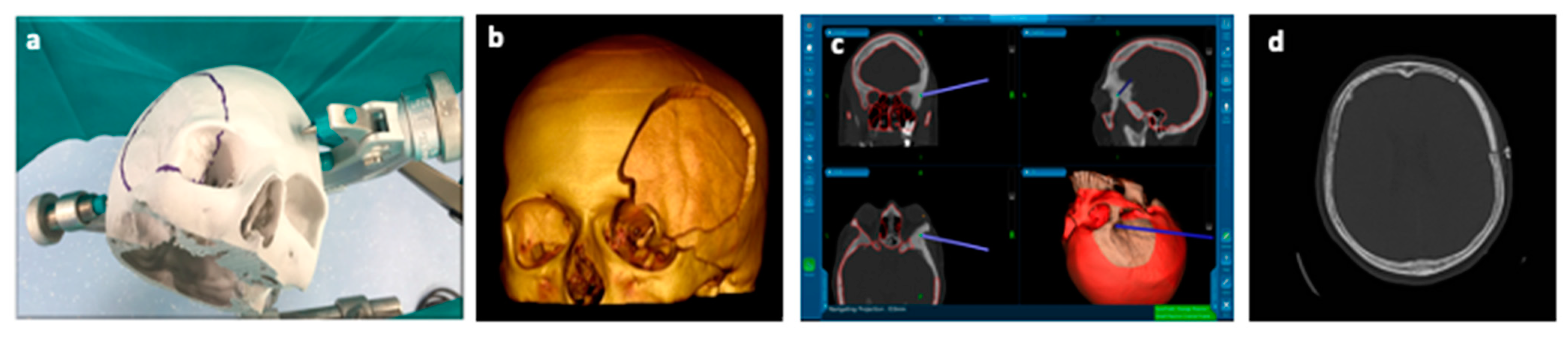 Polymers 13 01452 g007 Polymers 13 01452 g007