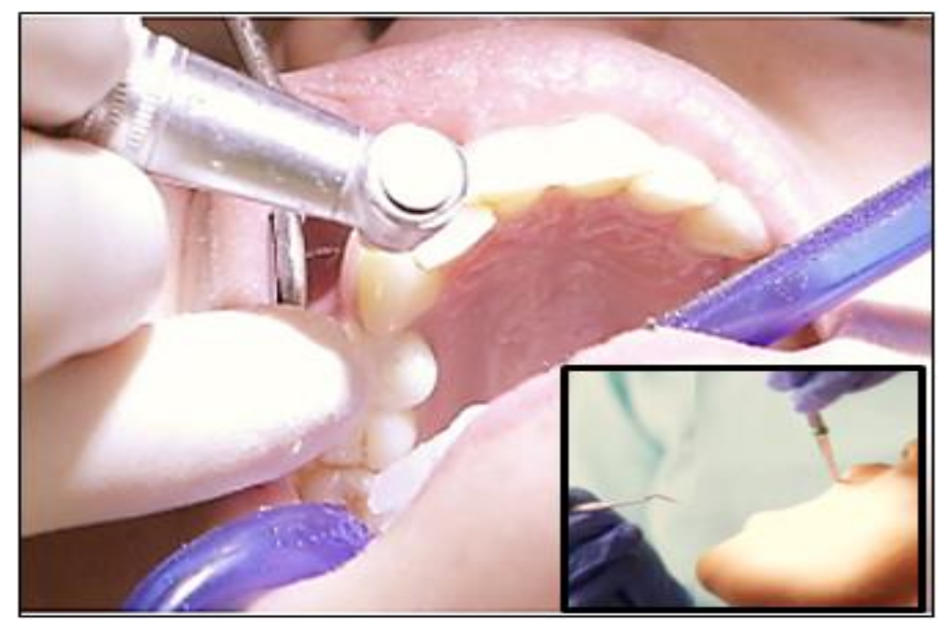 Polymers 13 01865 g015