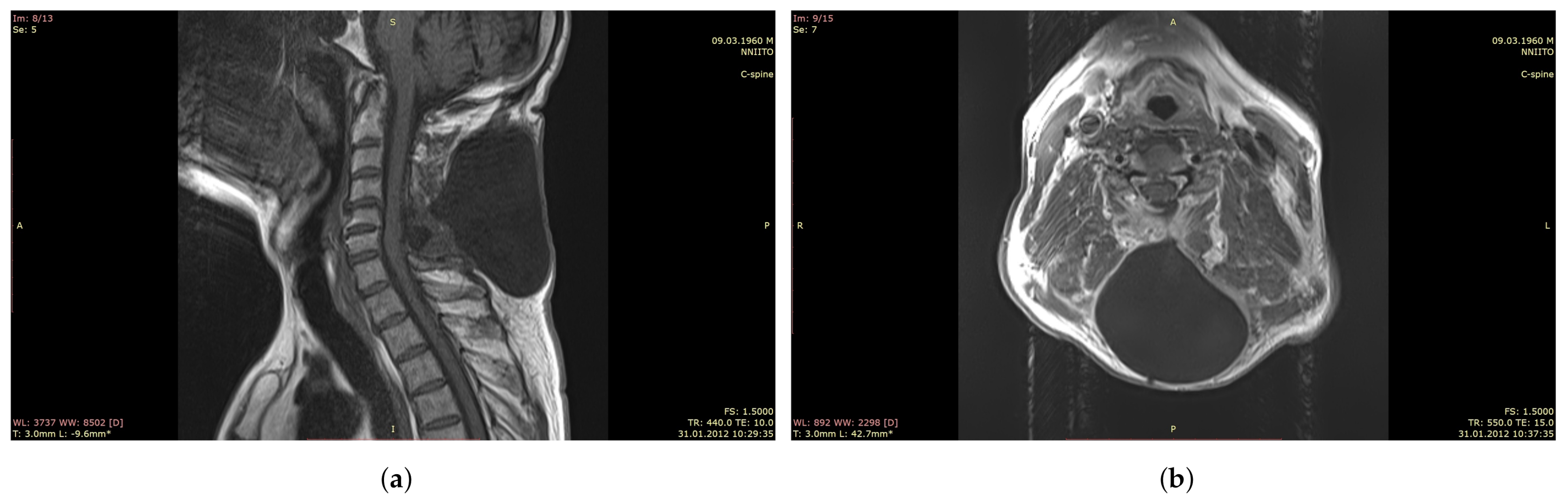 Polymers 13 01995 g001 Polymers 13 01995 g001