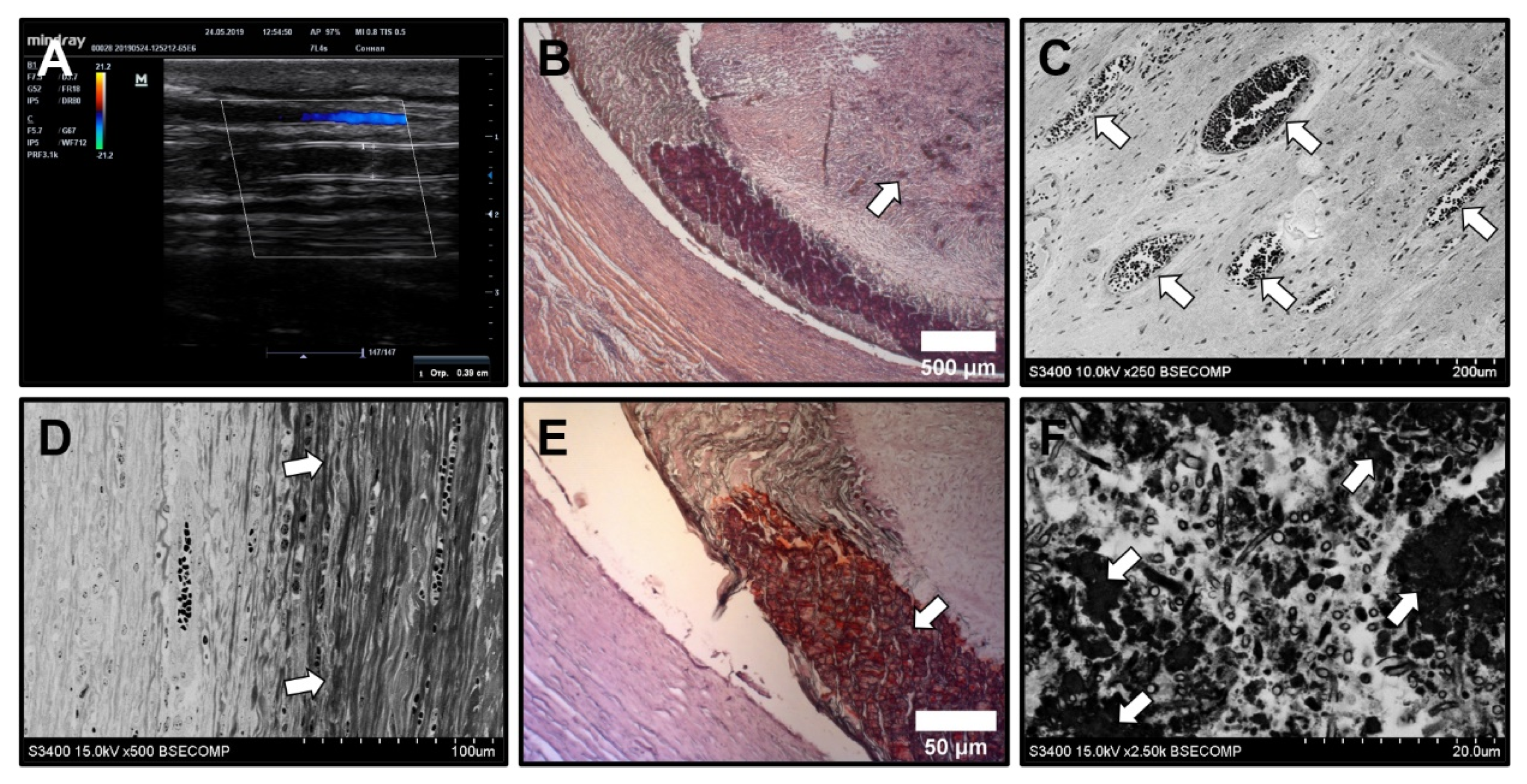 Polymers 13 02637 g008