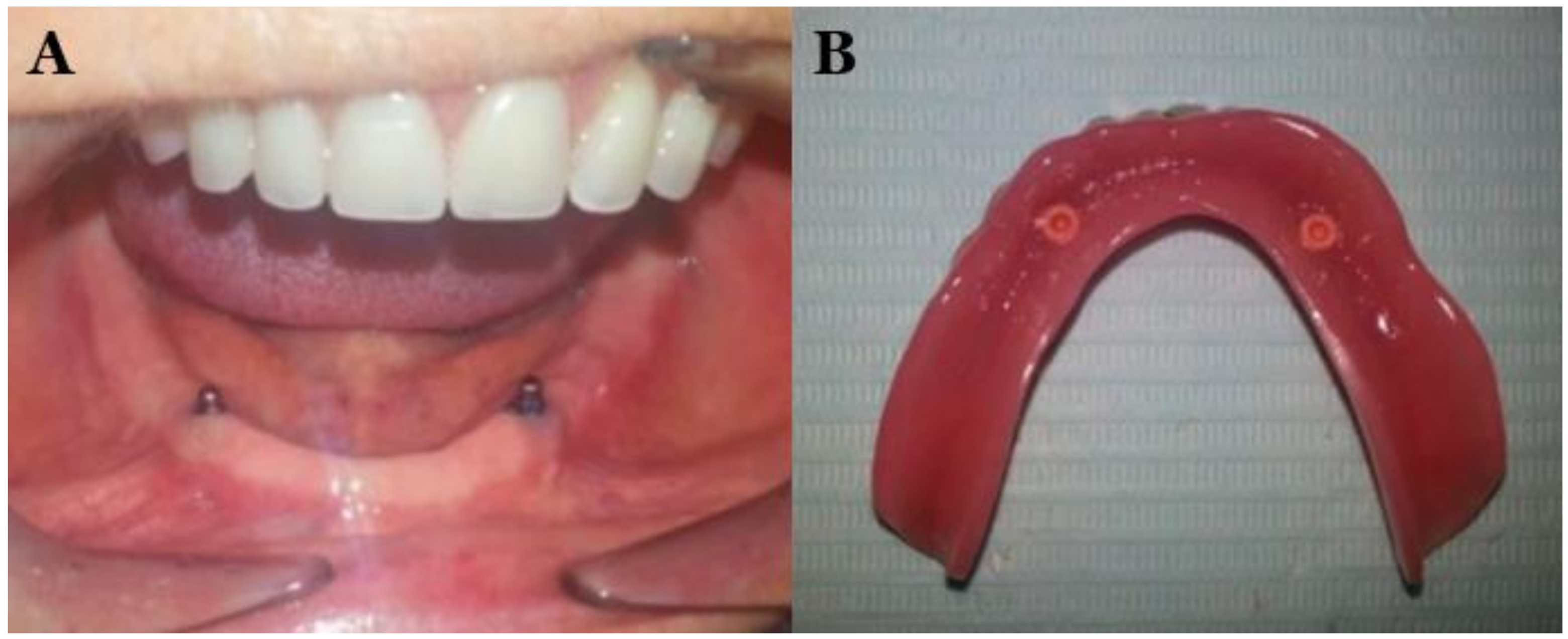 Polymers 13 03248 g001