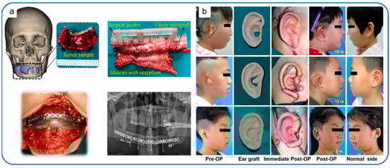 Polymers 14 00566 g005