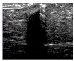 Polymers 14 00722 i018