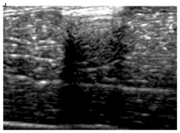 Polymers 14 00722 i024
