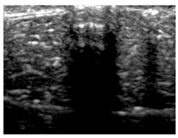 Polymers 14 00722 i033