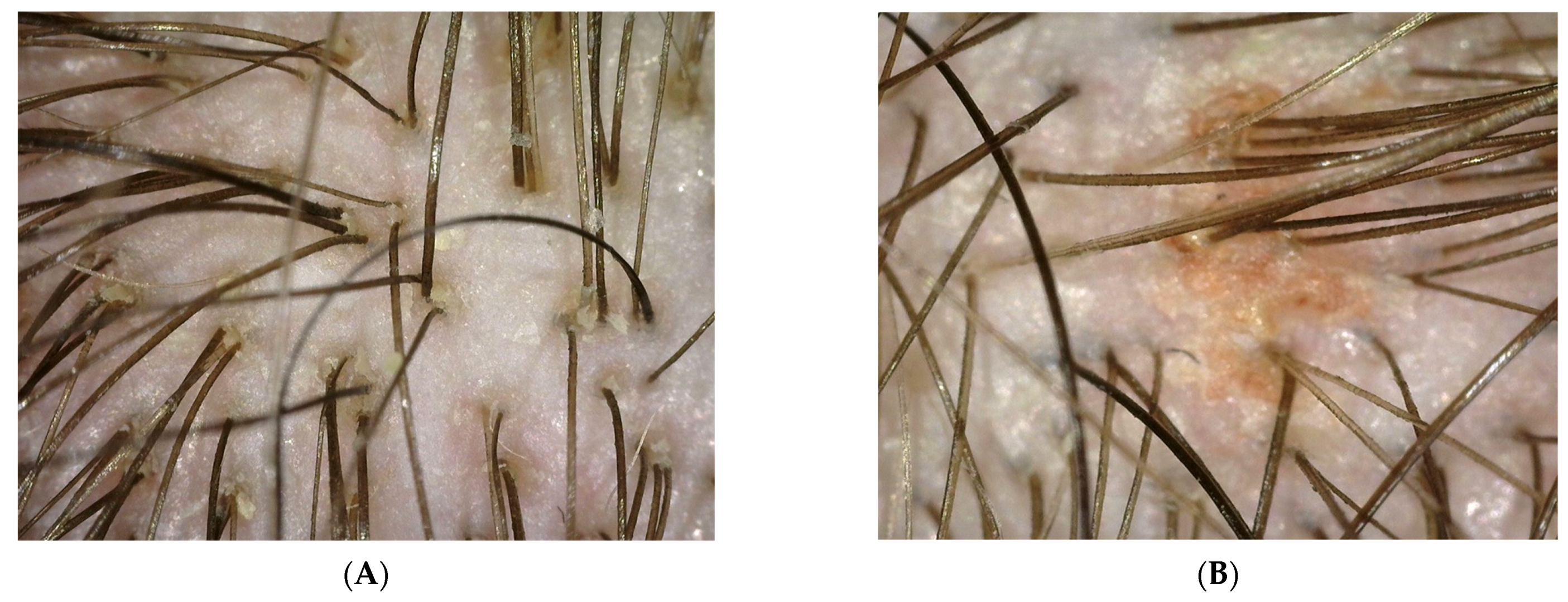 Polymers 14 00749 g002