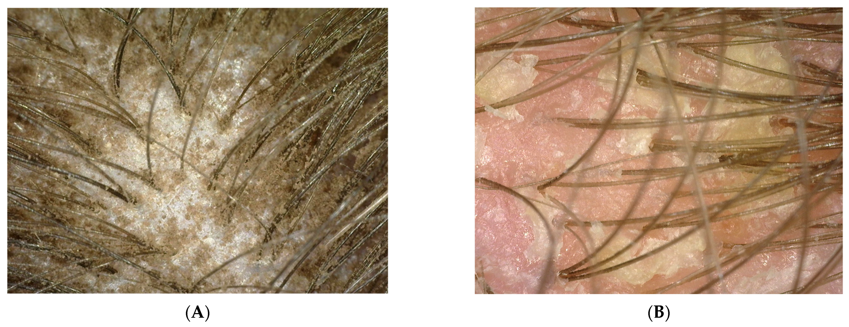 Polymers 14 00749 g003