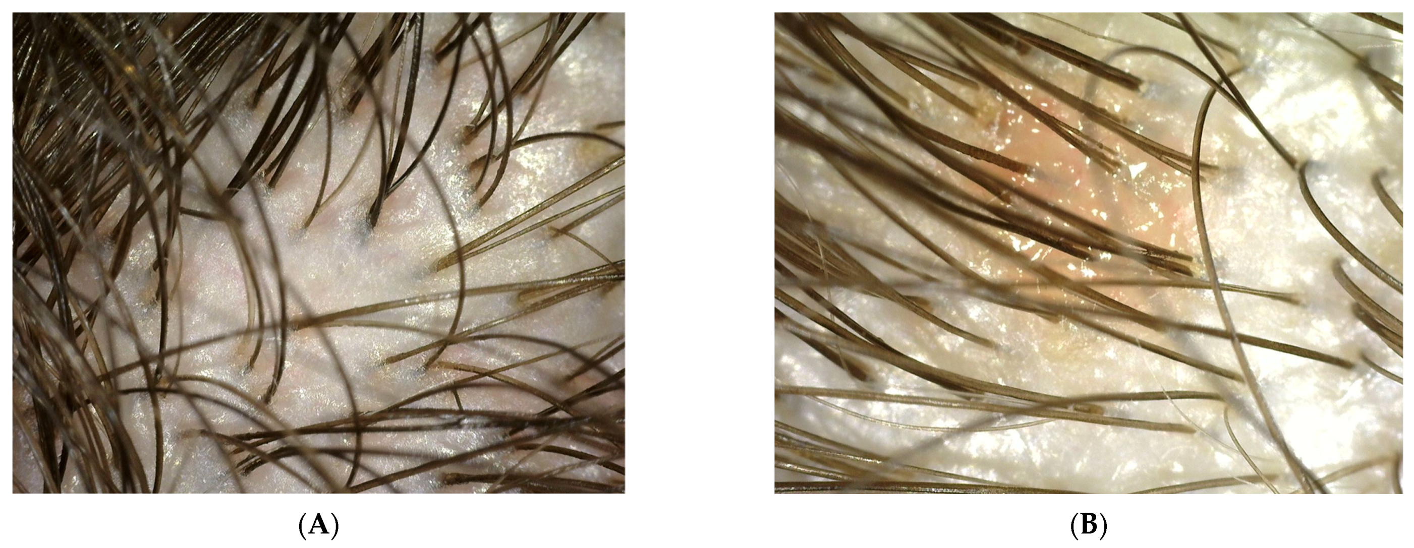 Polymers 14 00749 g004