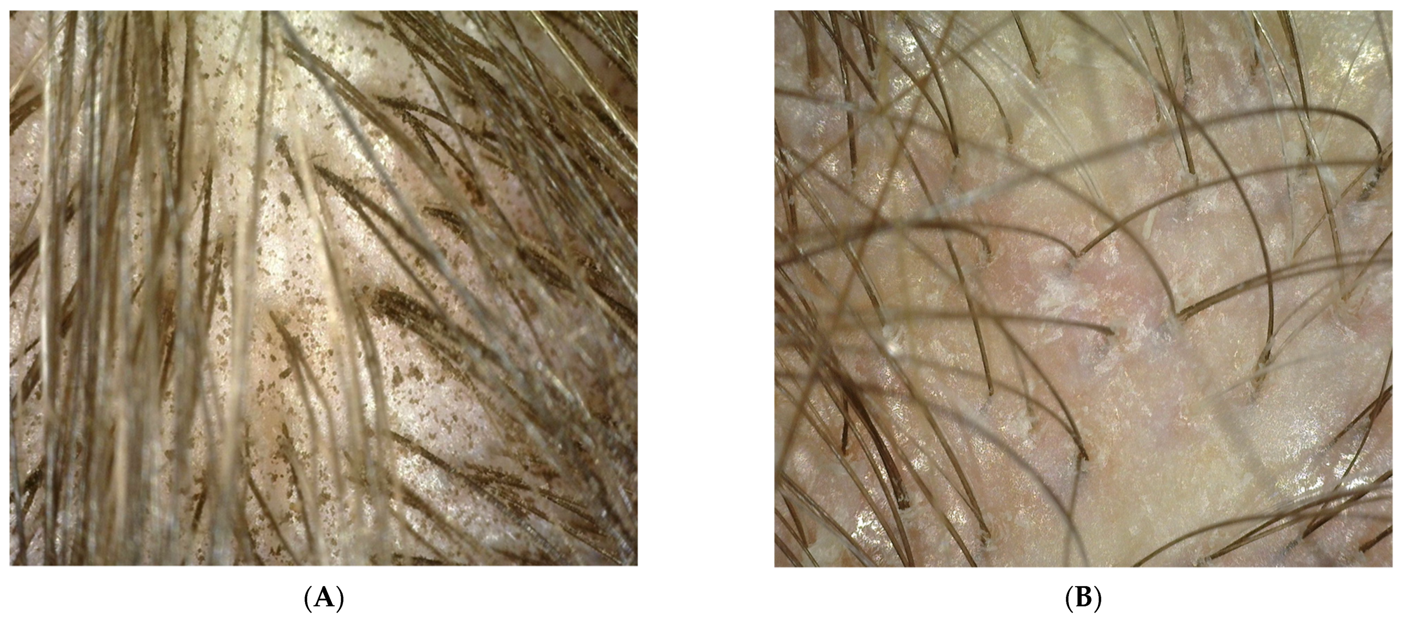 Polymers 14 00749 g005