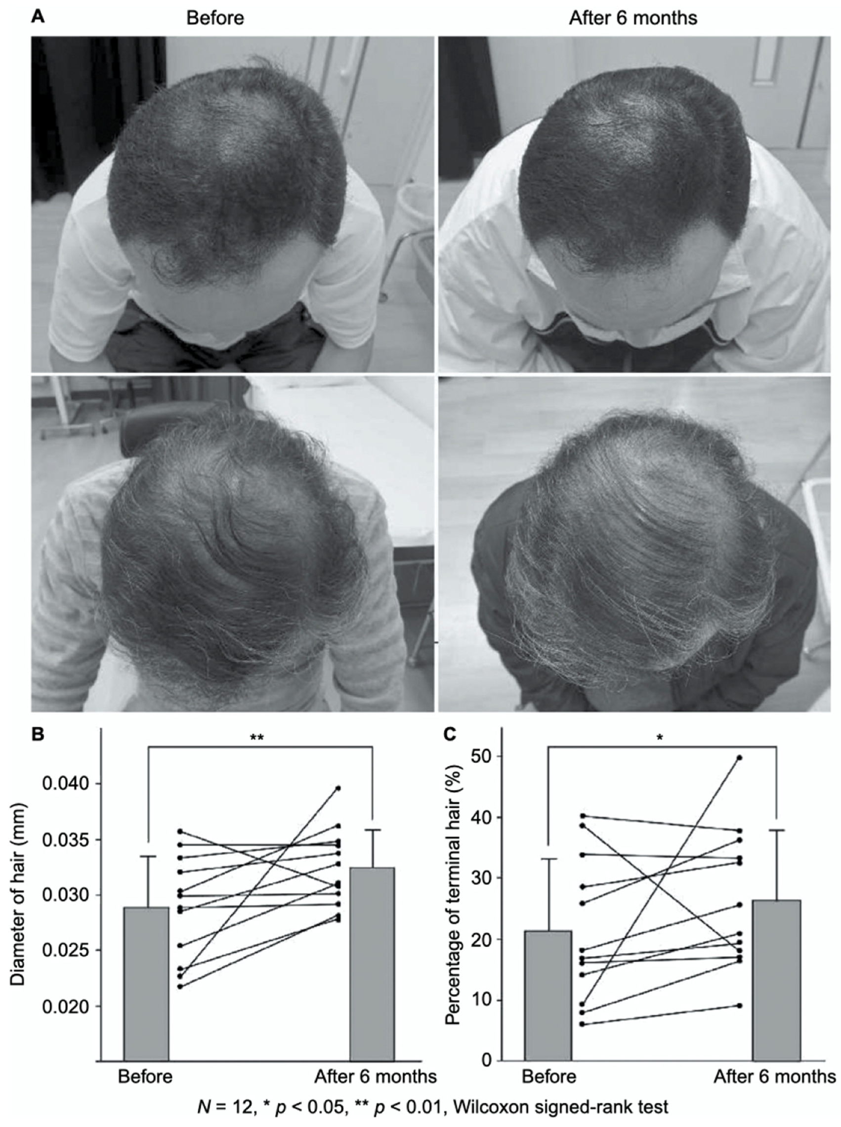 Polymers 14 00932 g003