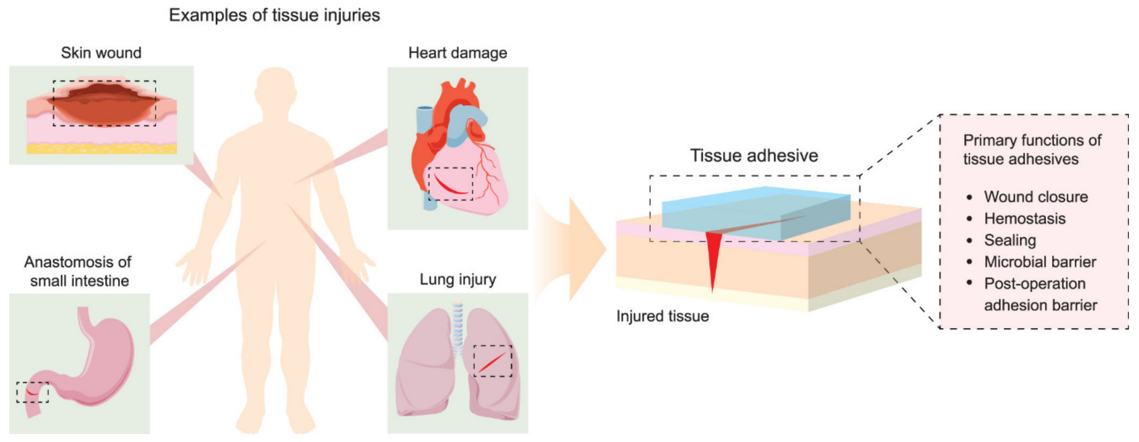 Polymers 14 00951 g005
