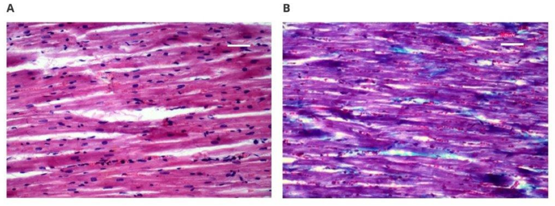 Polymers 14 01002 g004