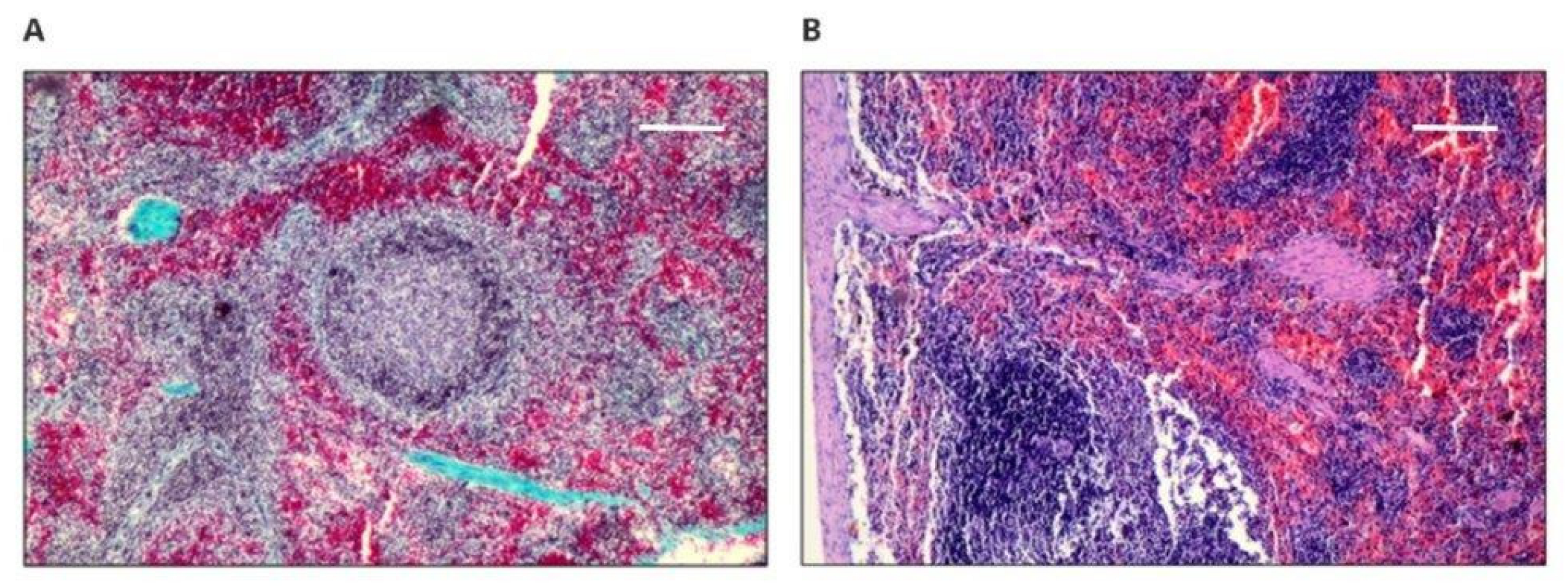 Polymers 14 01002 g005