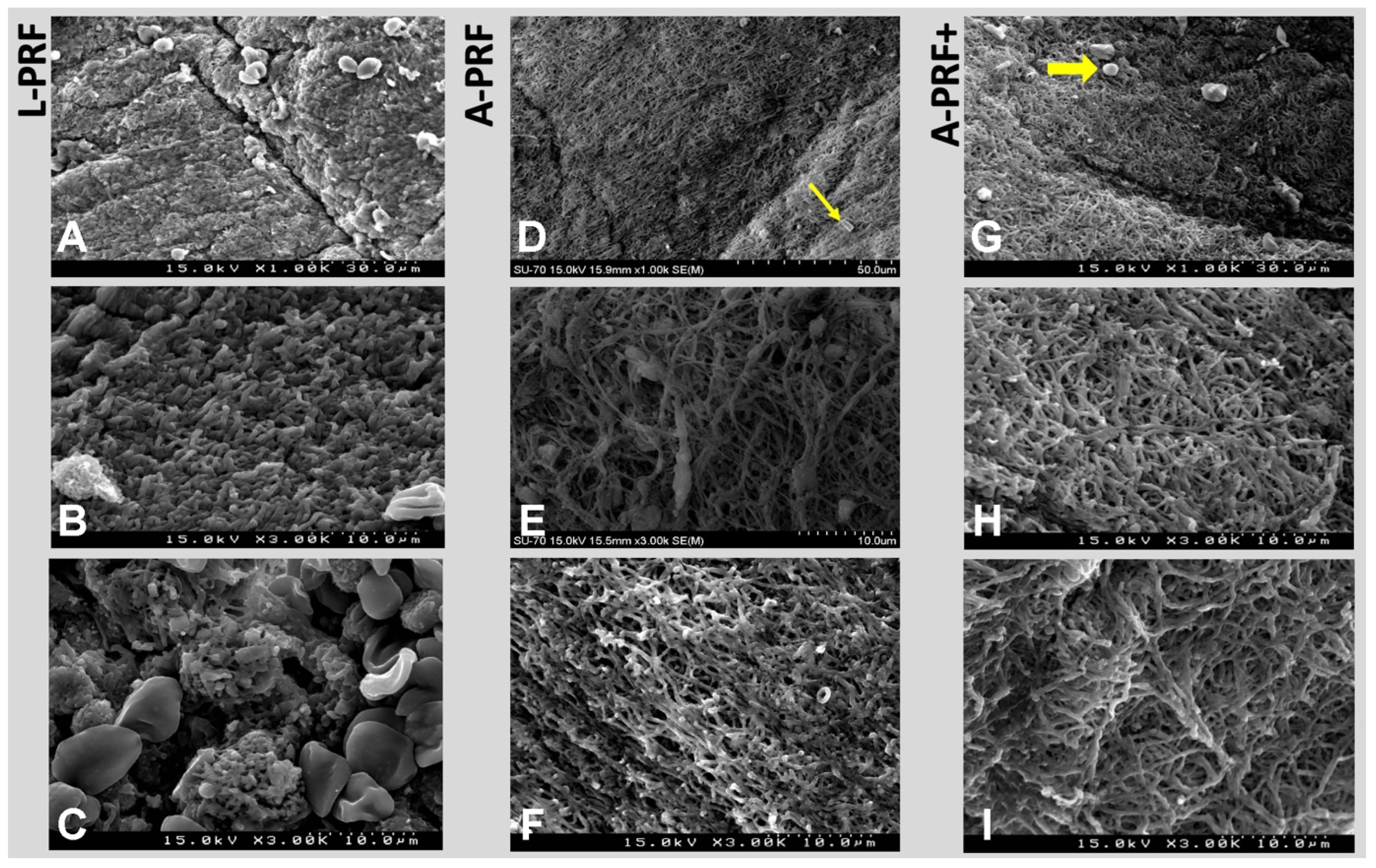 Polymers 14 01392 g005