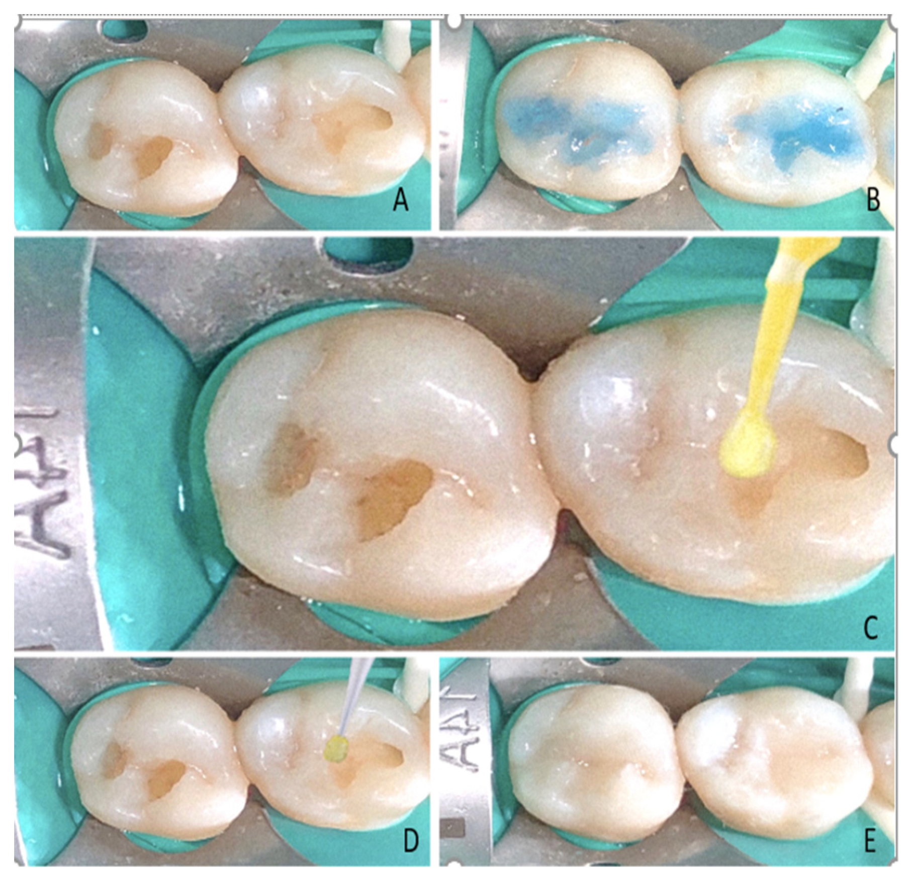 Polymers 14 01417 g003