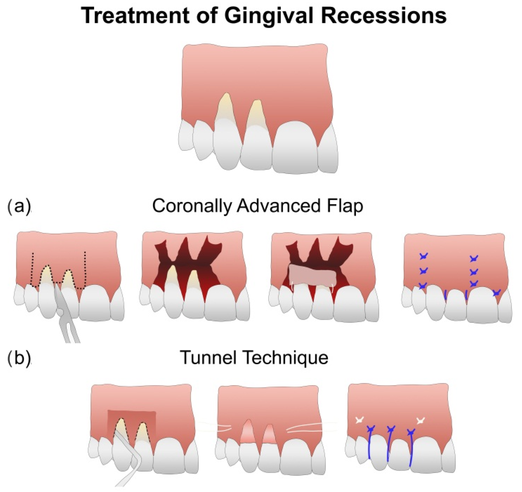 Polymers 14 01453 g001