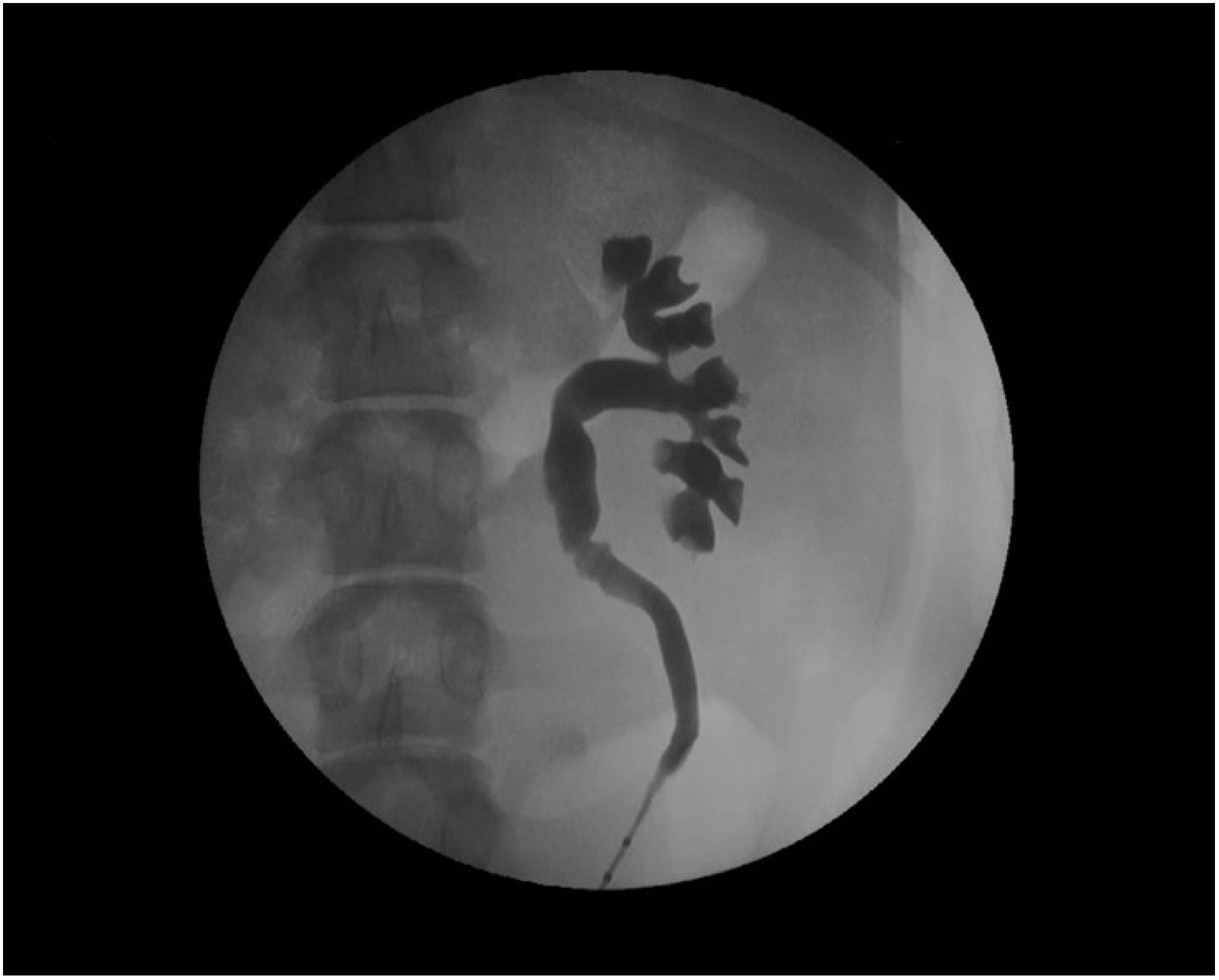 Polymers 14 01641 g004