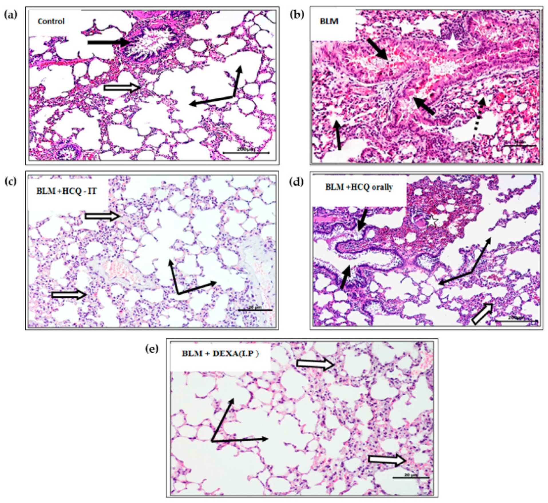 Polymers 14 02616 g005